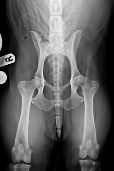 Pre op total hip replacement