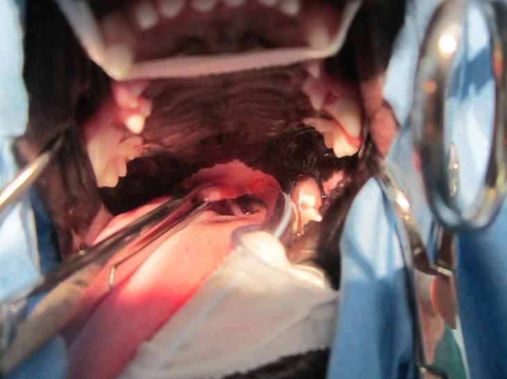 Soft Palate Resection