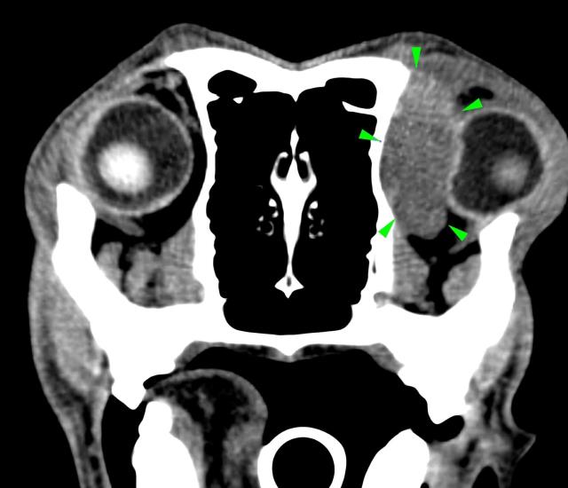 CT Scan1