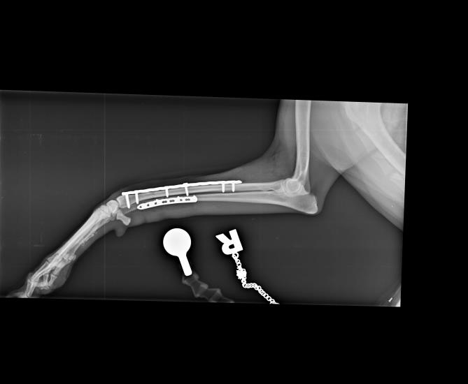 Fracture 2 X-Ray