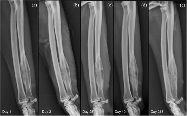 Xray cat Sterile osteomyelitis