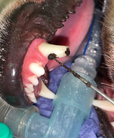 Pulp exposure in a canine tooth fracture