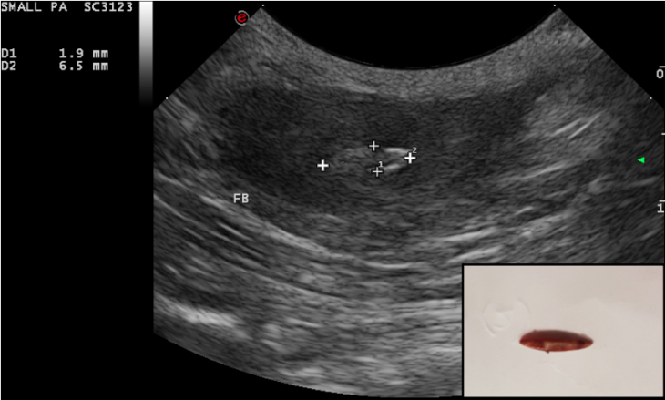 referral ultrasound of dog witth grass seed