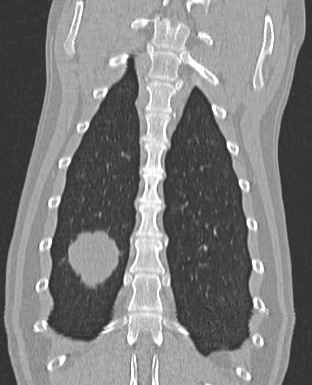 Coronal CT reconstructions 