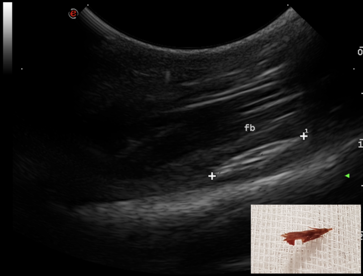 Referral ultrasound of grass seed FB