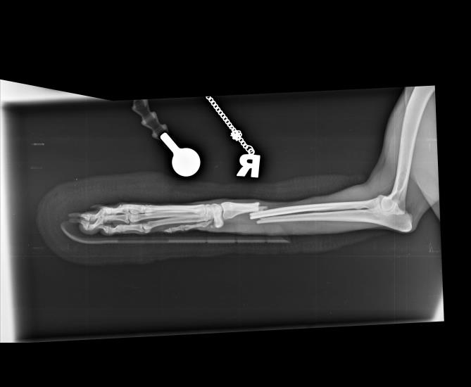 Treatment of a radius and ulna fracture News Eastcott Referral
