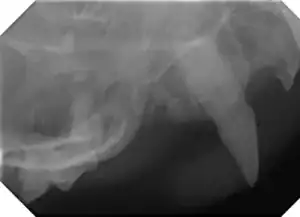 An x-ray showing a root fragment in the nasal cavity