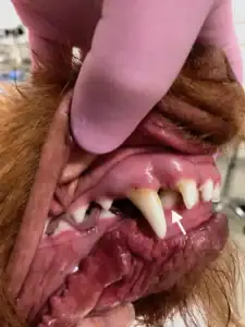 The right lower canine tooth is displaced