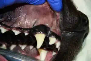 Canine tooth that has been displaced outwards and the overlying gum has been torn