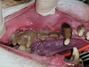 The end stage of gum disease with enormous concretions of calculus and severe infections arounbd the tooth's roots.