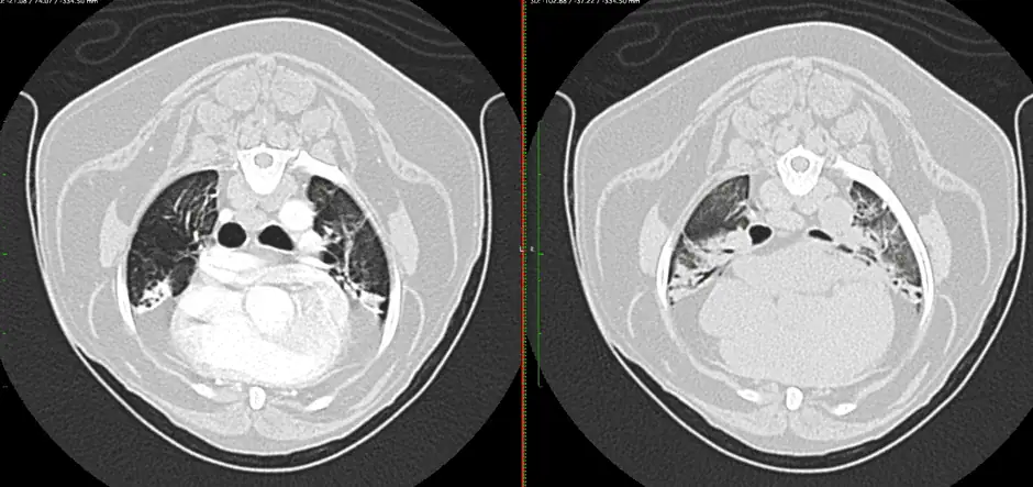 CT scan of a chest