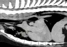 Tommy's CT scan results